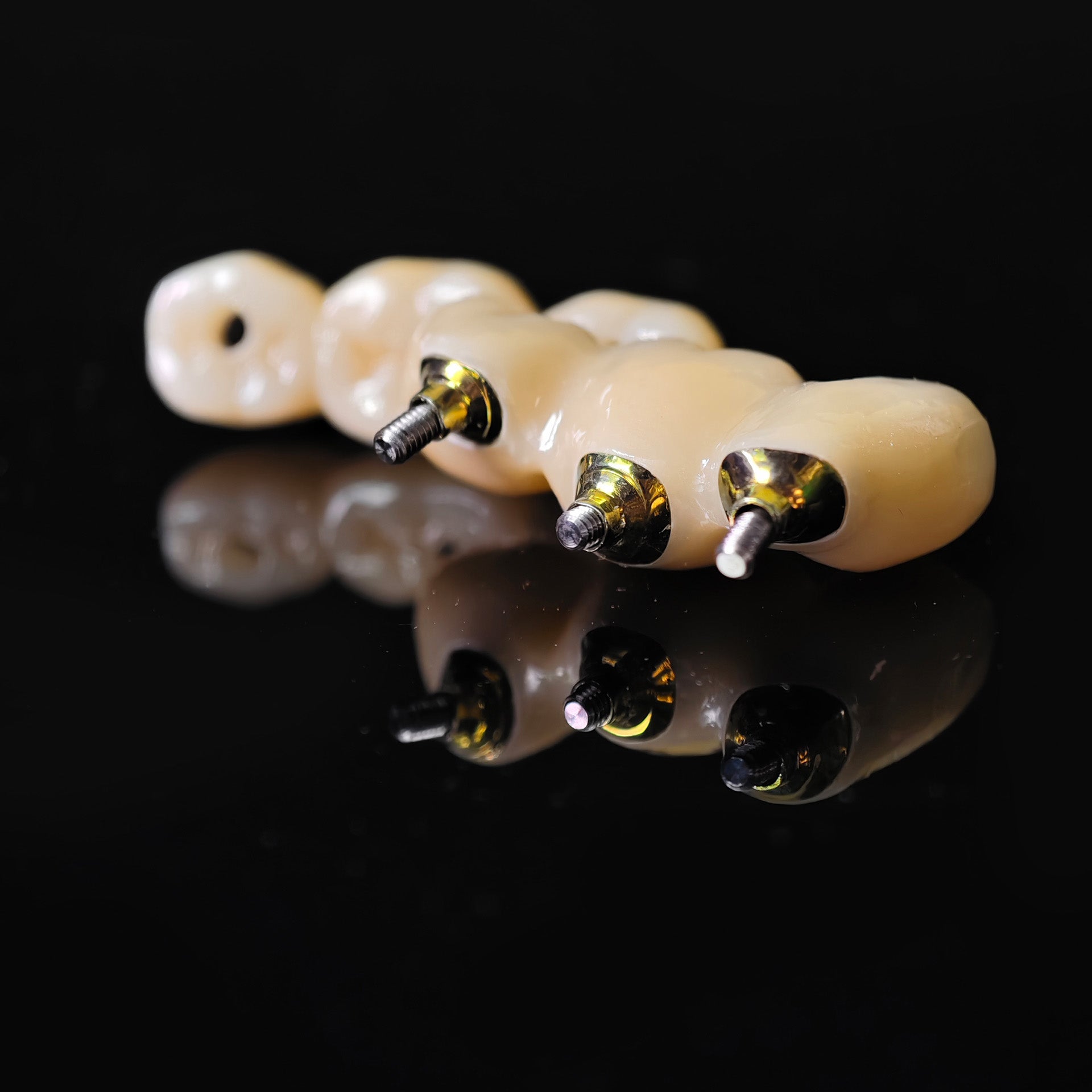 Zirconia Bridge With Screw Retained Gold Plating