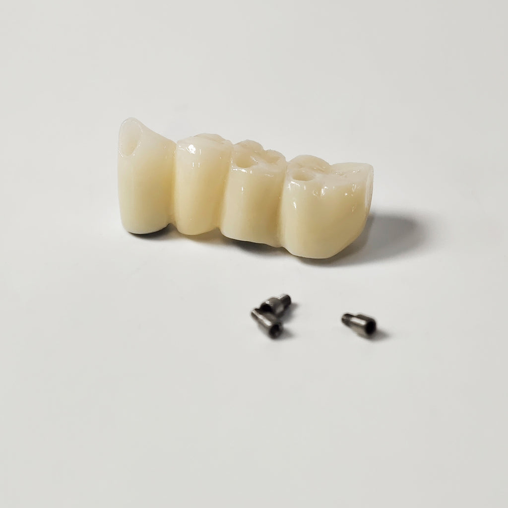 Zirconia Bridge With Ti-Base Screw Retained