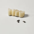 Zirconia Bridge With Ti-Base Screw Retained