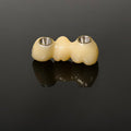 Zirconia Bridge With Ti-Base Screw Retained