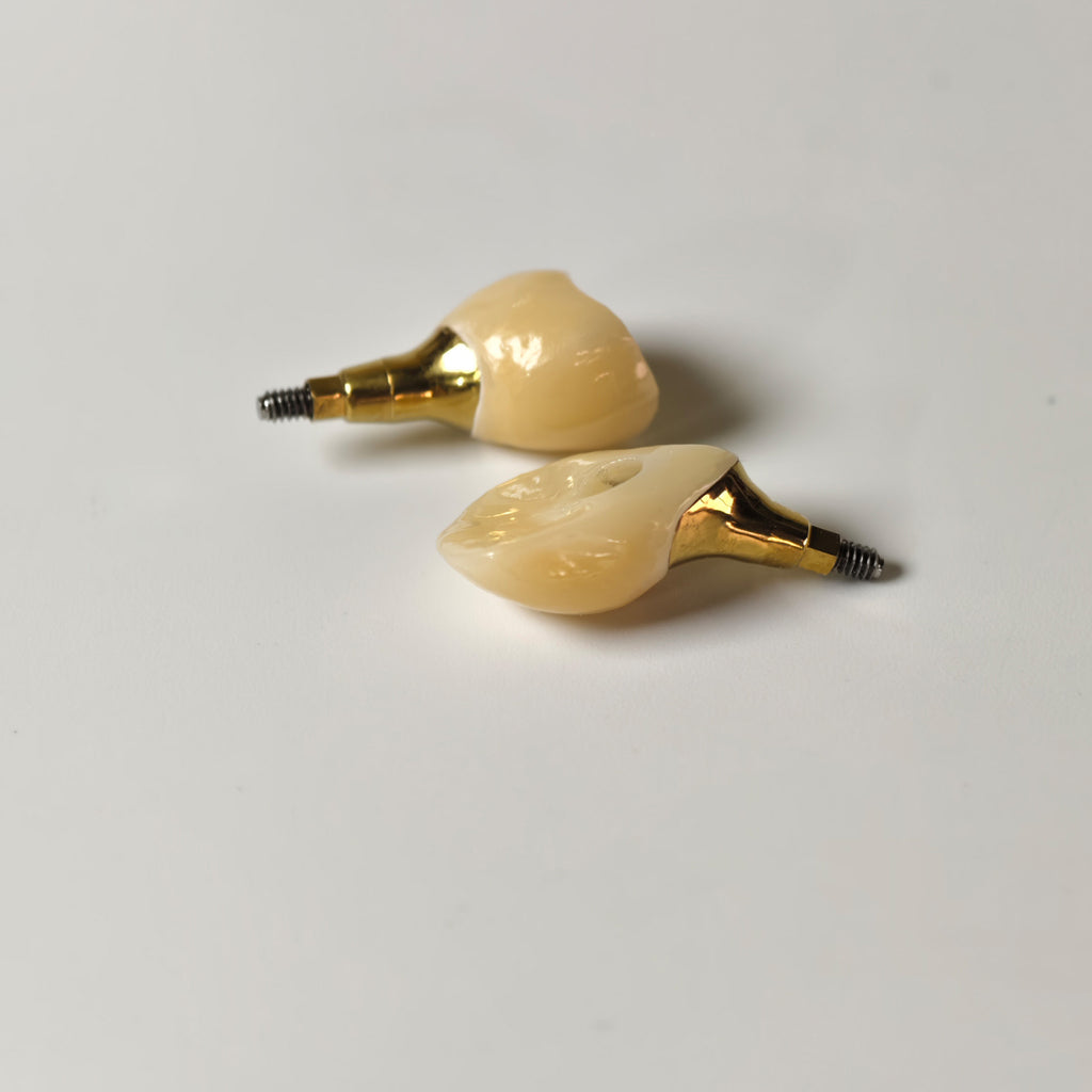 Zirconia Crowns With Gold-Plated Abutment