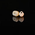 Zirconia Crowns With Screw Retained