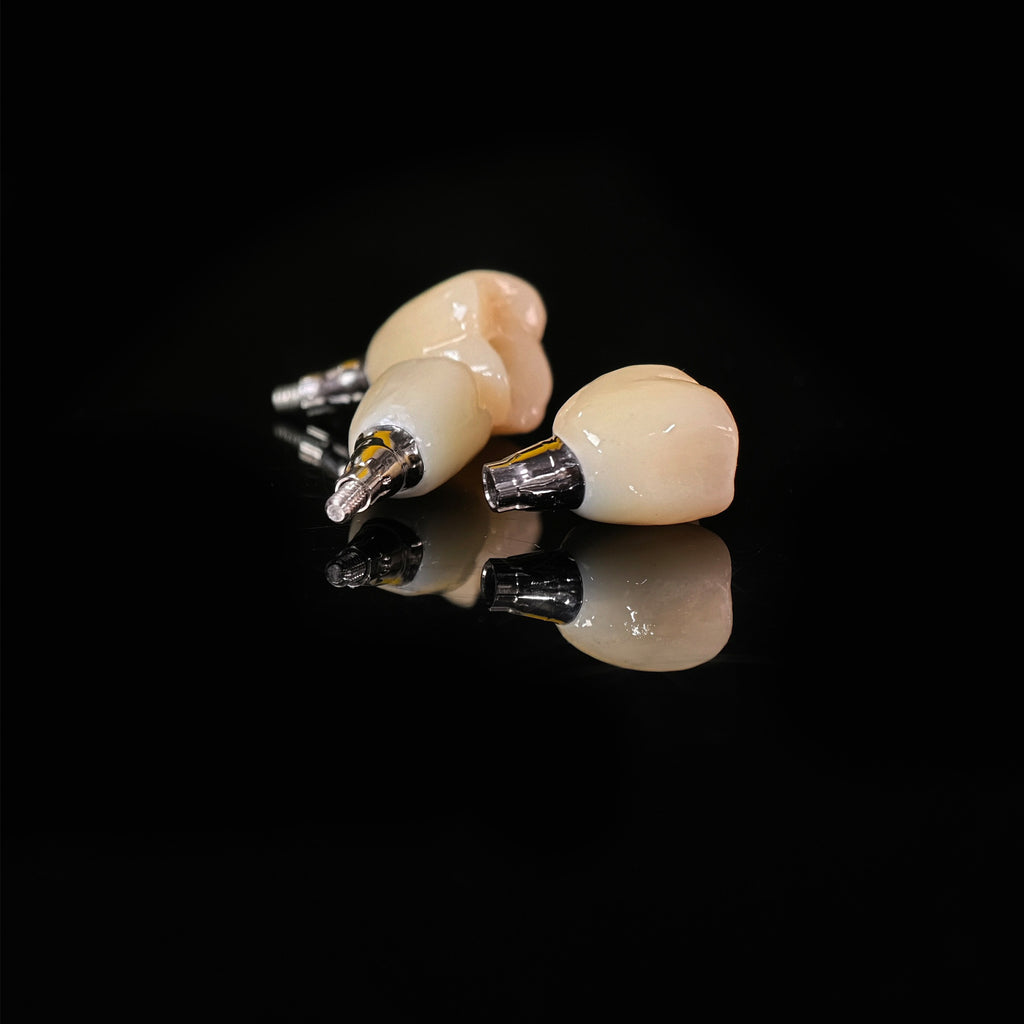 Zirconia Crowns With Screw Retained