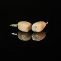 Zirconia Crowns With Screw Retained
