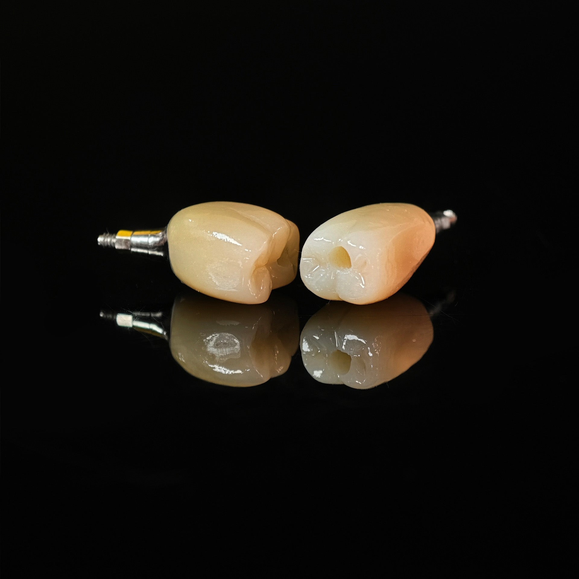 Zirconia Crowns With Screw Retained