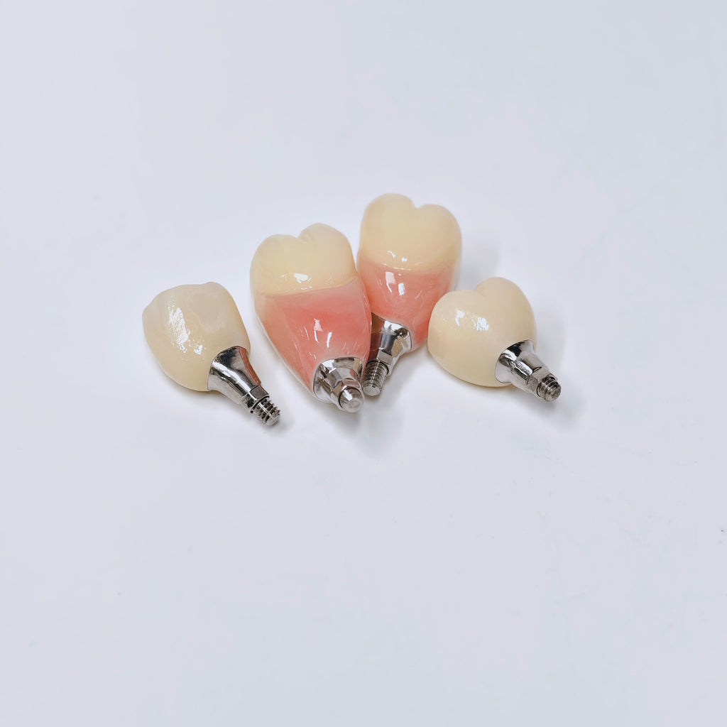 Zirconia Crowns With Screw Retained
