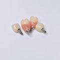 Zirconia Crowns With Screw Retained