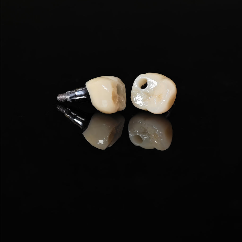 Zirconia Crowns With Screw Retained