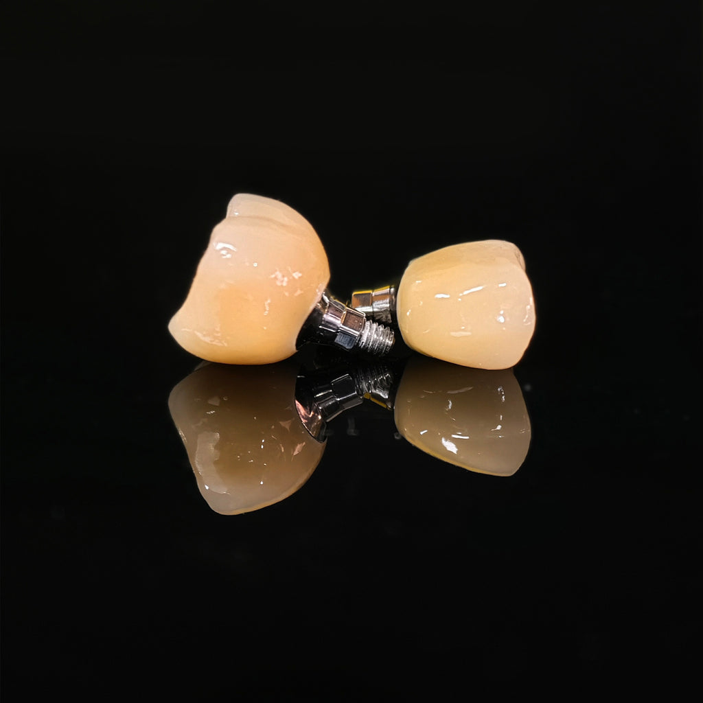 Zirconia Crowns With Screw Retained