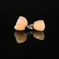 Zirconia Crowns With Screw Retained