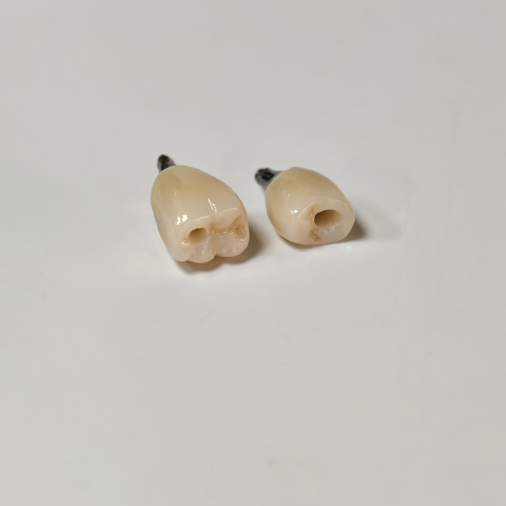 Zirconia Crowns With Screw Retained