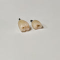 Zirconia Crowns With Screw Retained