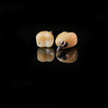 Zirconia Crowns With Screw Retained