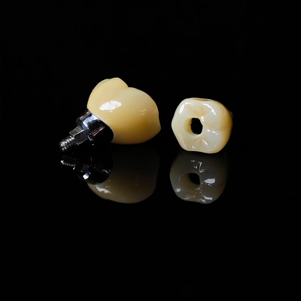 Zirconia Crowns With Screw Retained