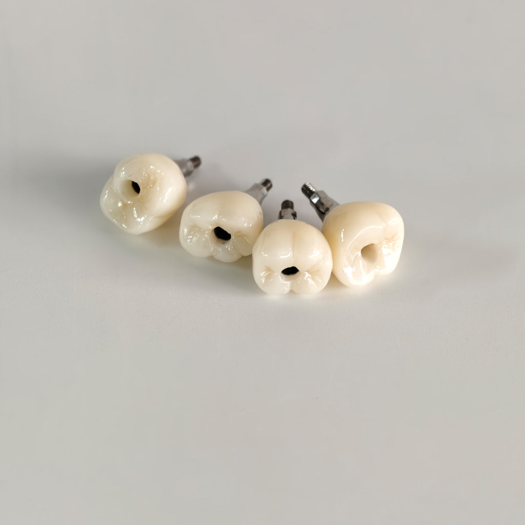 Zirconia Crowns With Screw Retained