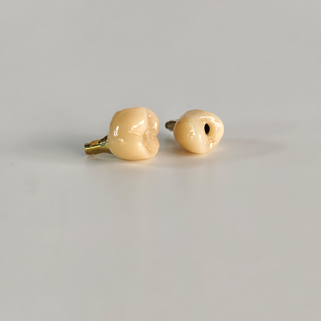 Zirconia Crowns With Screw Retained And Gold-Plated Custom Abutment