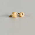 Zirconia Crowns With Screw Retained And Gold-Plated Custom Abutment