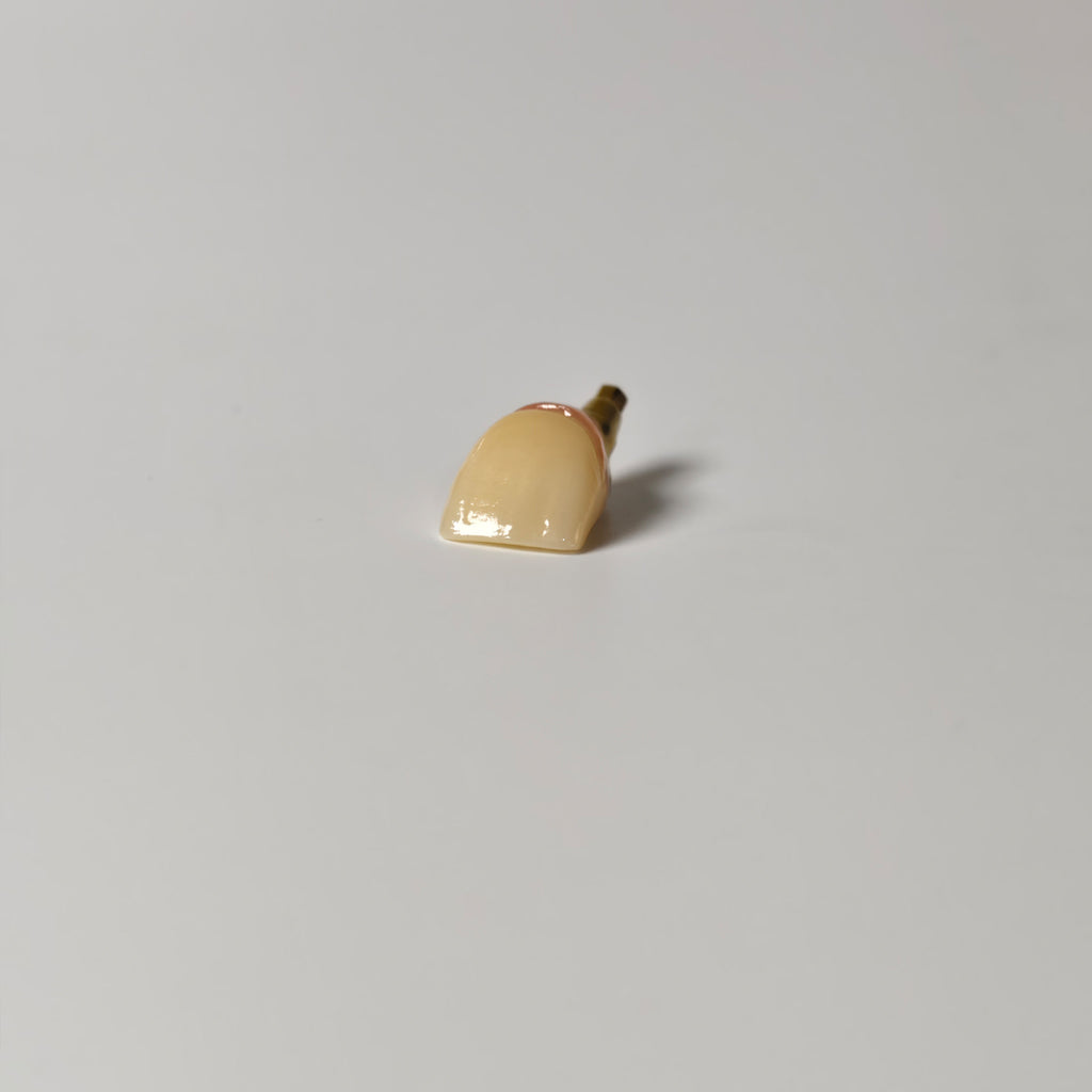 Zirconia Crown With Gold-Plated Abutment