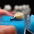 Zirconia Crown With Screw Retained