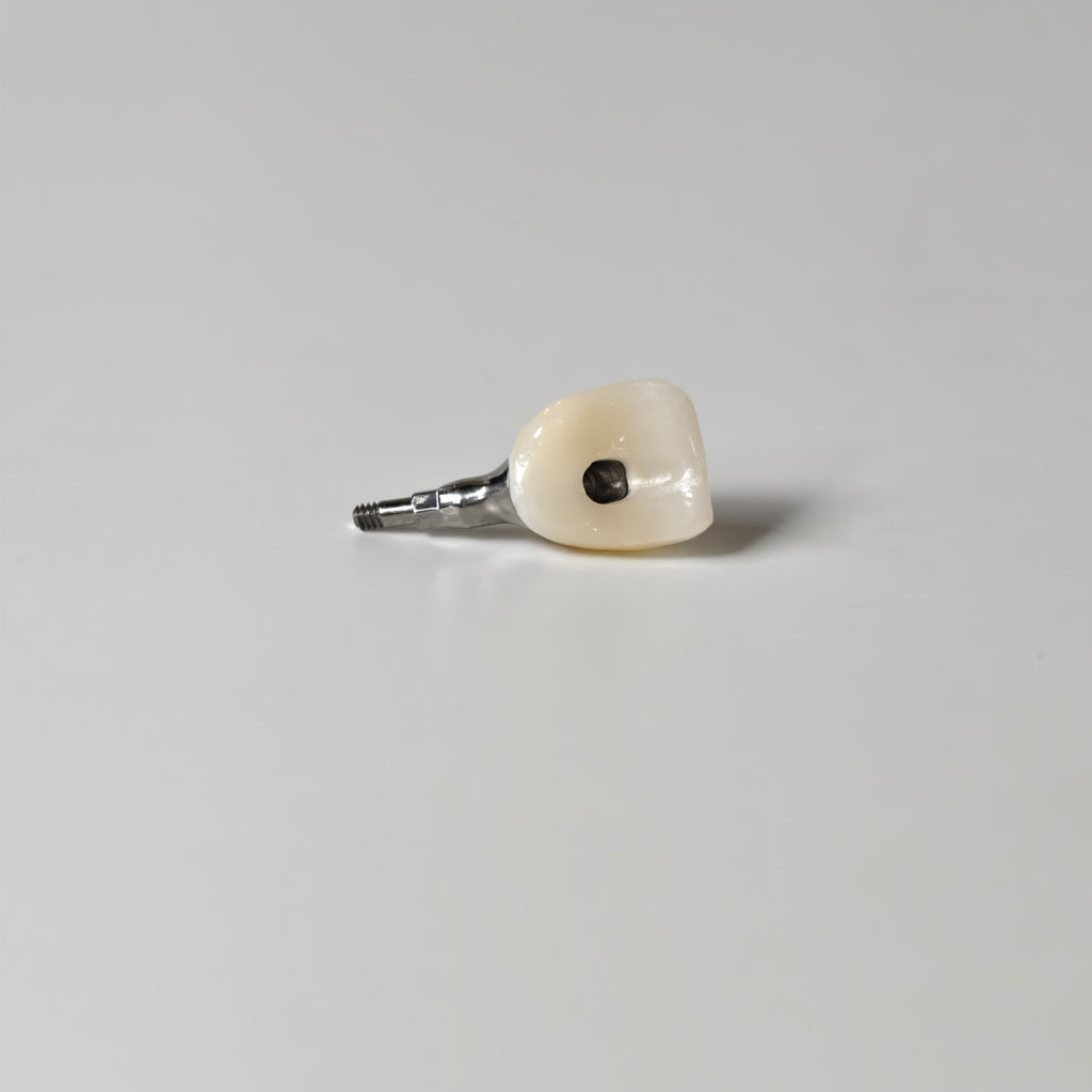 Zirconia Crown With Screw Retained