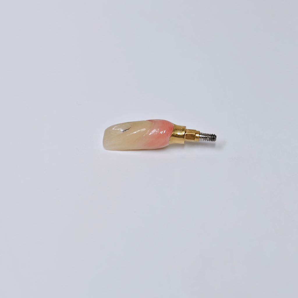 Zirconia Crown With Screw Retained