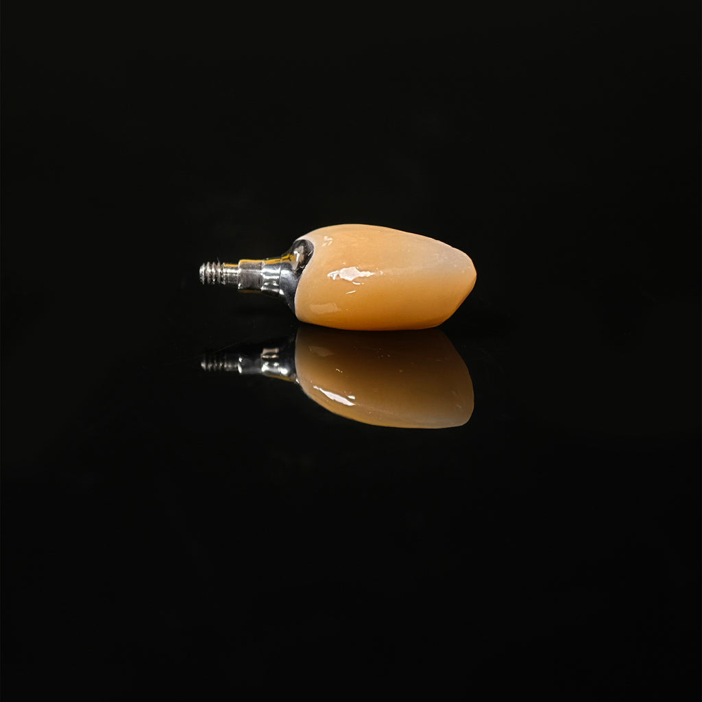Zirconia Crown With Screw Retained