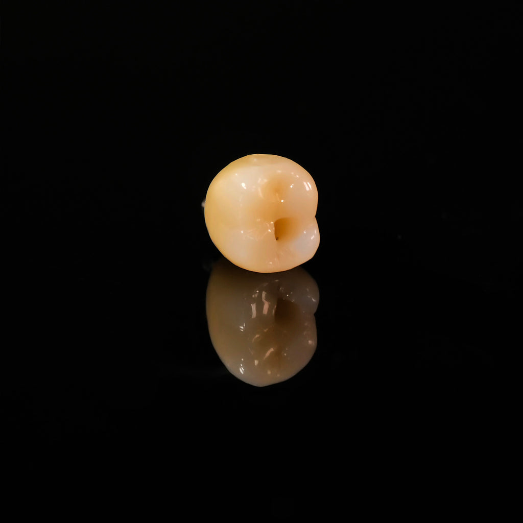 Zirconia Crown With Screw Retained