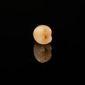 Zirconia Crown With Screw Retained