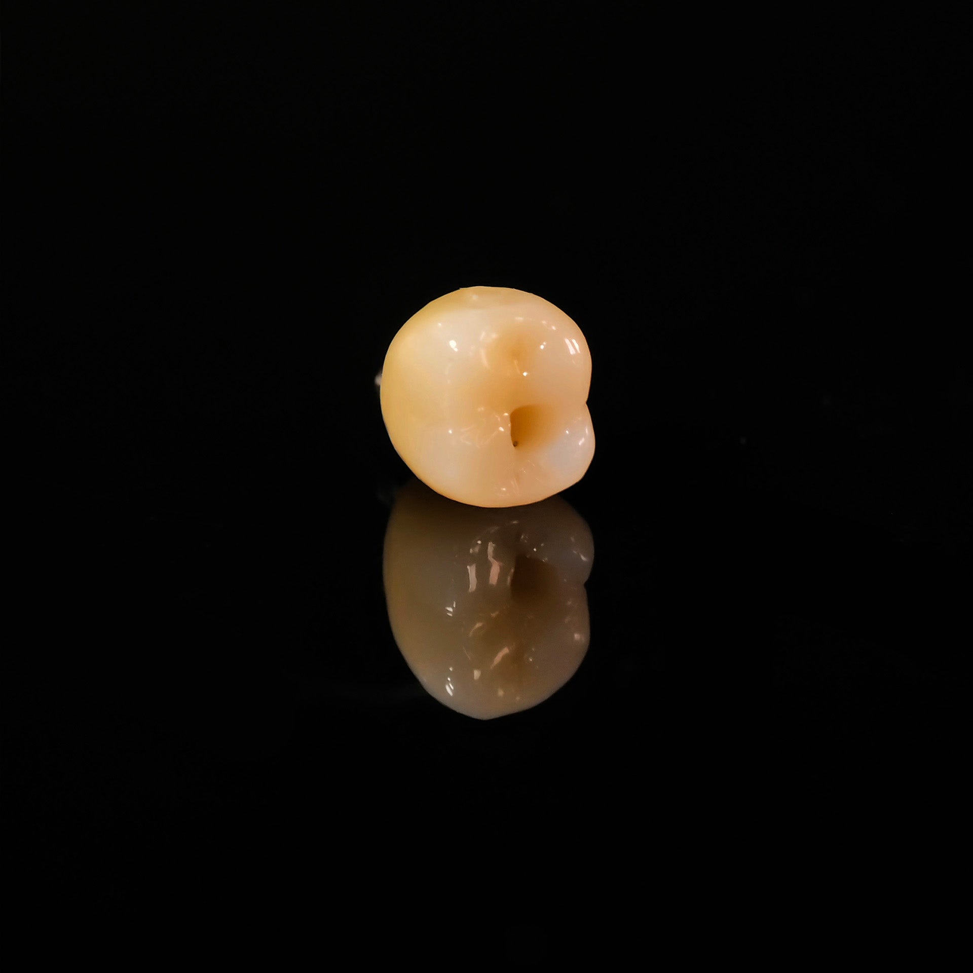 Zirconia Crown With Screw Retained
