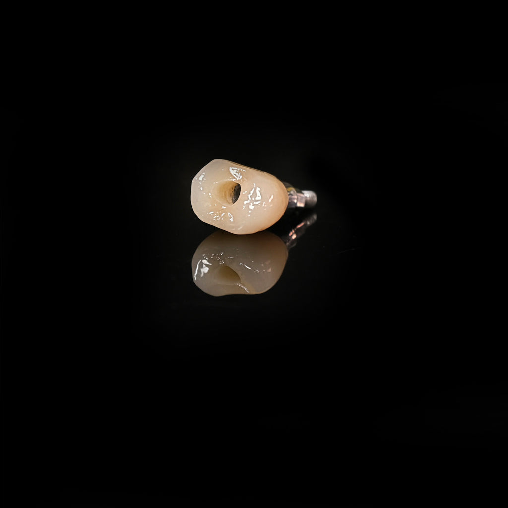 Zirconia Crown With Screw Retained