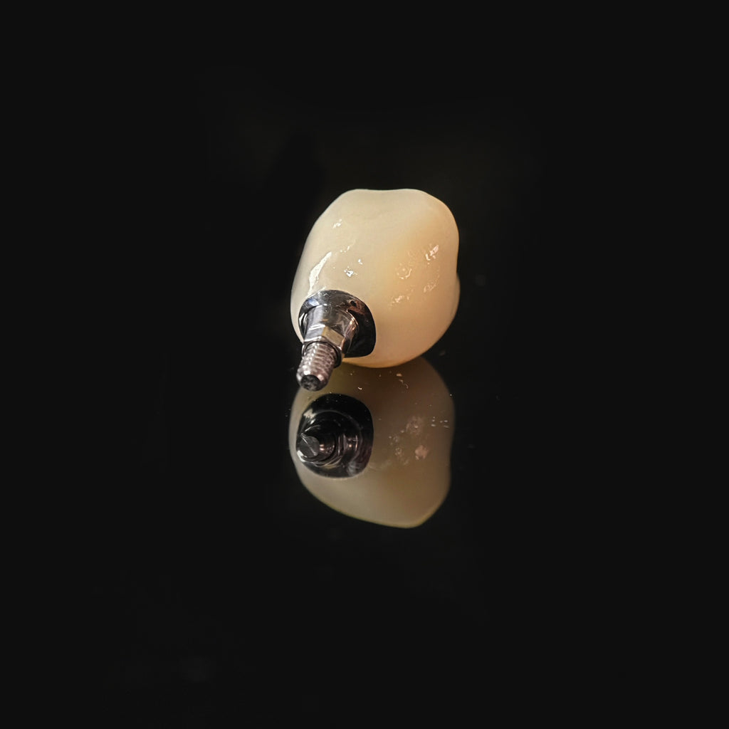 Zirconia Crown With Screw Retained