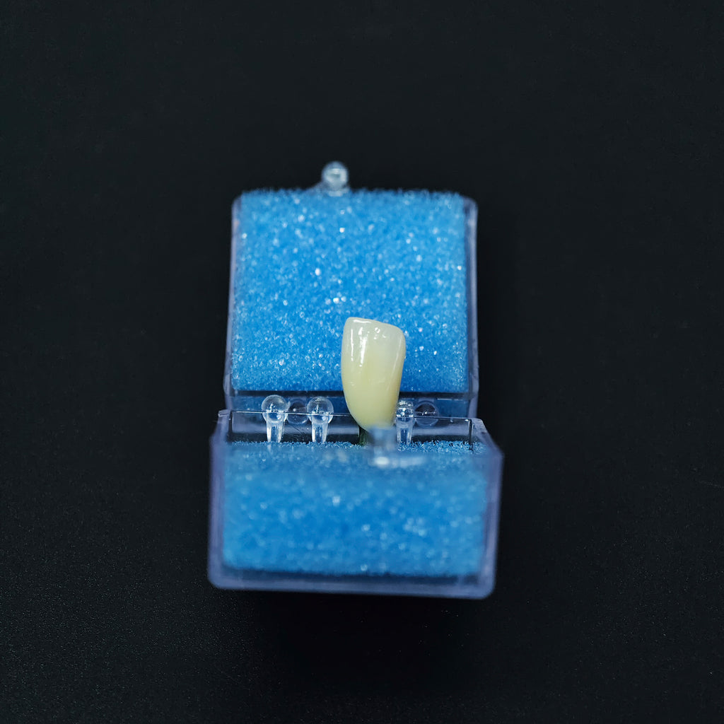 Zirconia Crown With Screw Retained