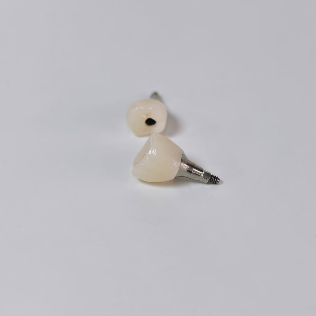 Zirconia Crown With Screw Retained