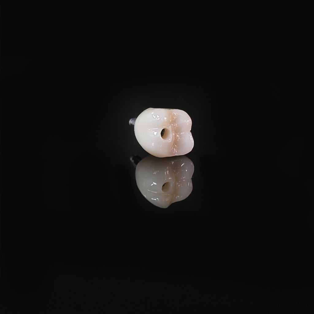 Zirconia Crown With Screw Retained