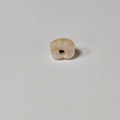 Zirconia Crown With Screw Retained