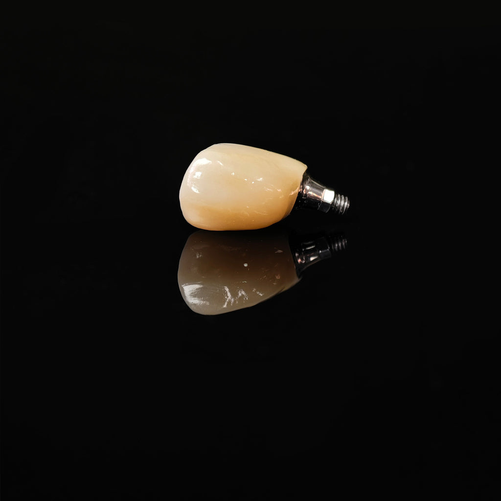 Zirconia Crown With Screw Retained
