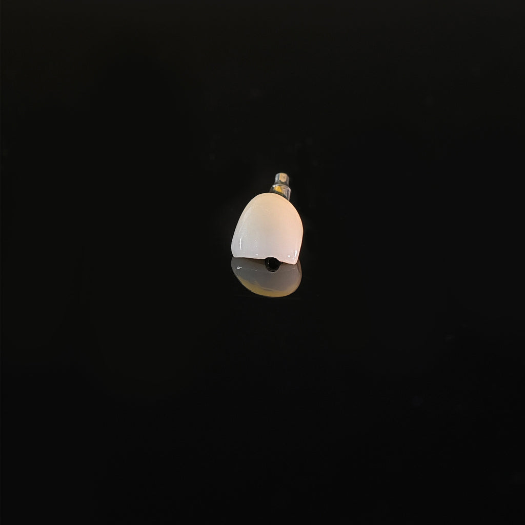 Zirconia Crown With Screw Retained
