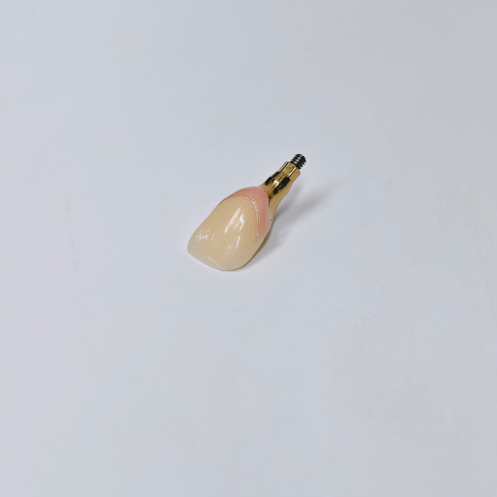 Zirconia Crown With Screw Retained