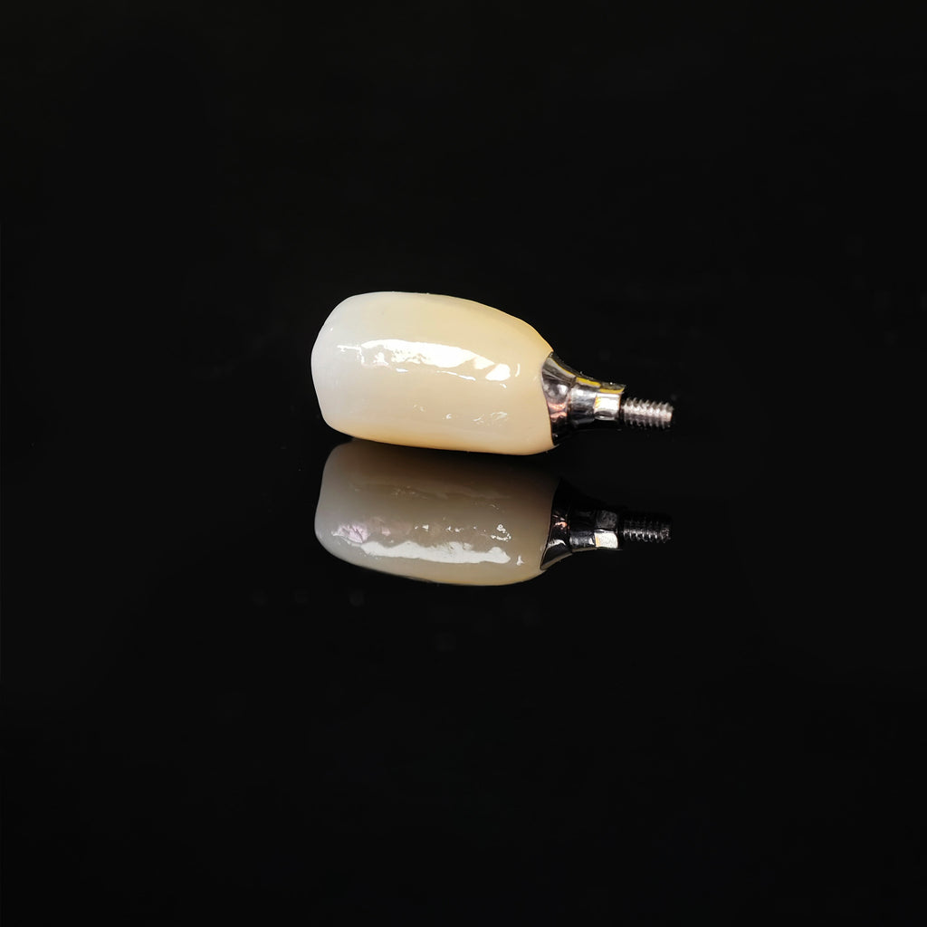 Zirconia Crown With Screw Retained