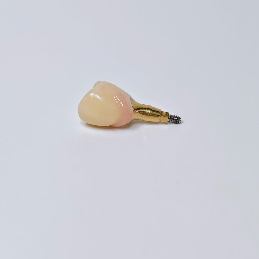 Zirconia Crown With Screw Retained