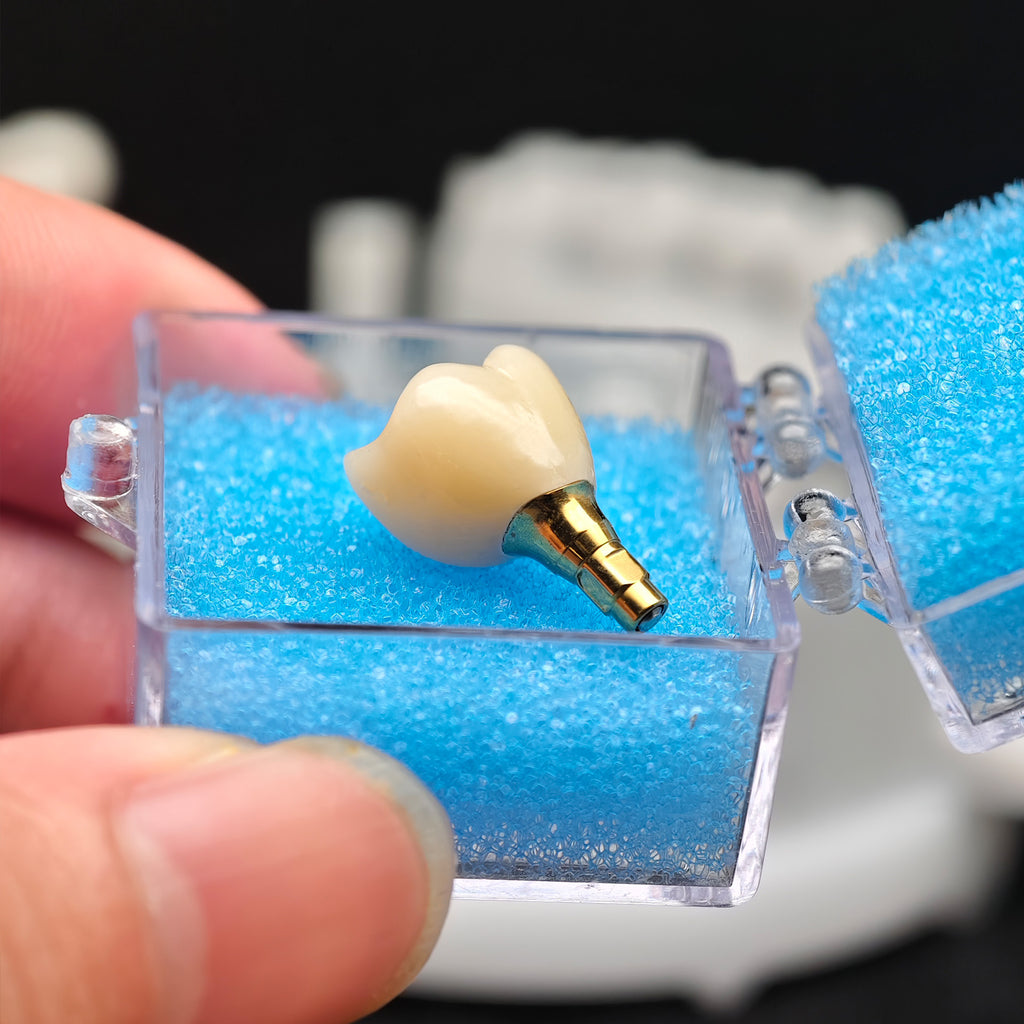 Zirconia Crown With Screw Retained