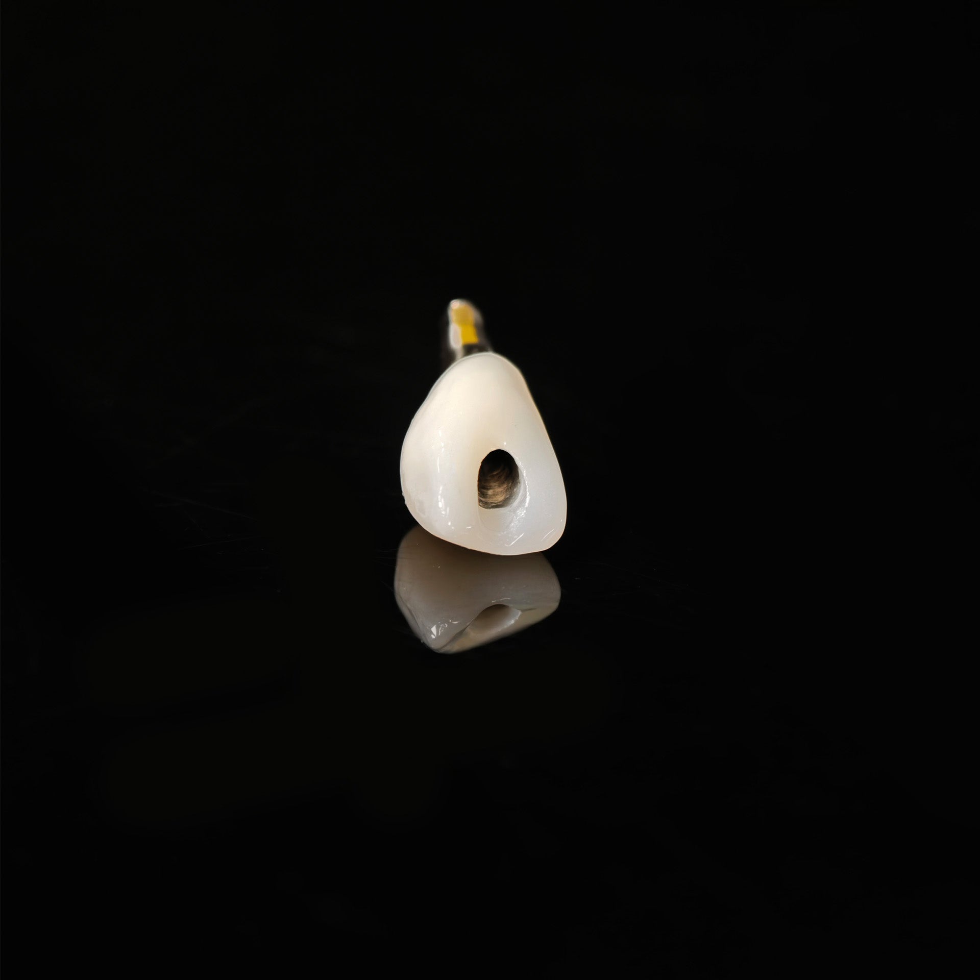 Zirconia Crown With Screw Retained