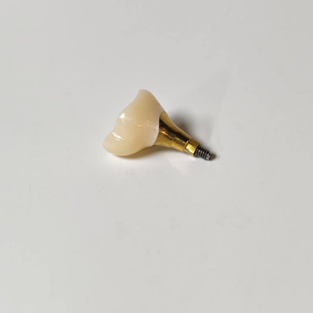 Zirconia Crown With Screw Retained