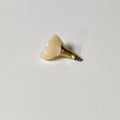 Zirconia Crown With Screw Retained