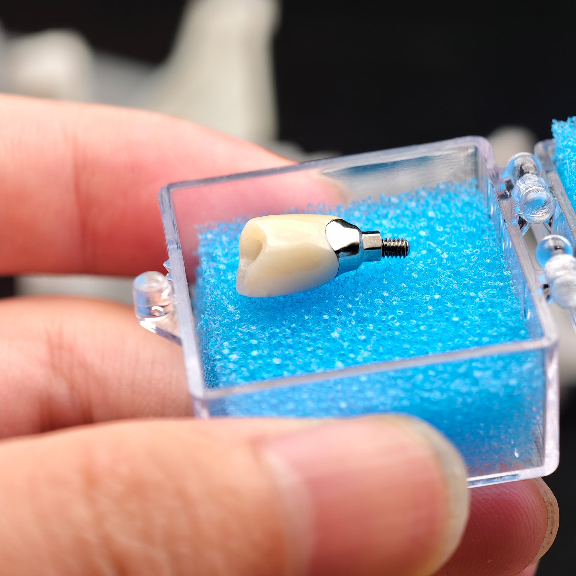 Zirconia Crown With Screw Retained