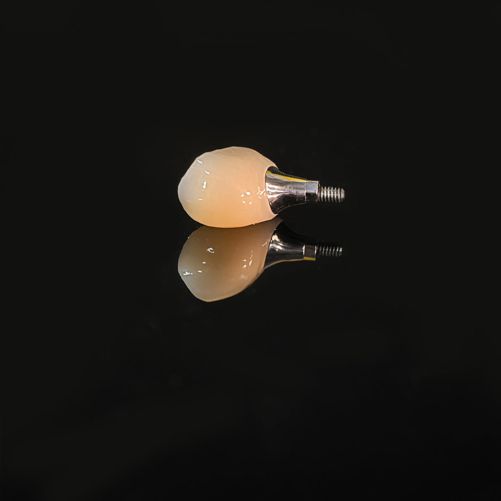 Zirconia Crown With Screw Retained