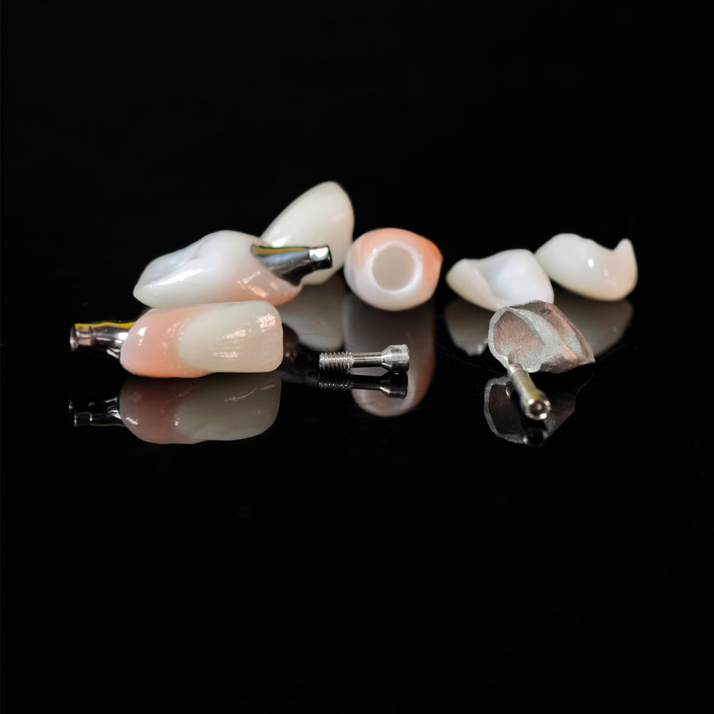 Zirconia Crown With Screw Retained And Cement Retained And Ceramic Veneers