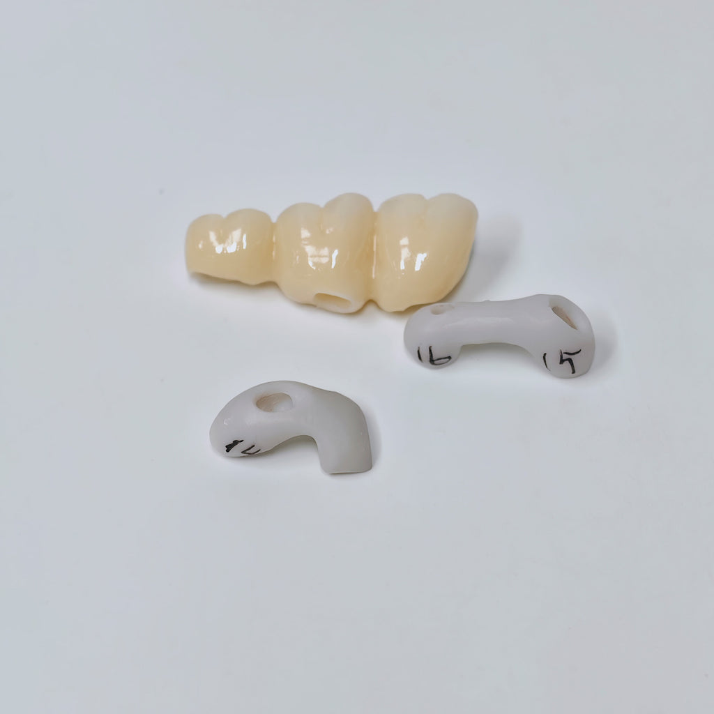 Zirconia Implant Bridge Screwmentable Dental Crown