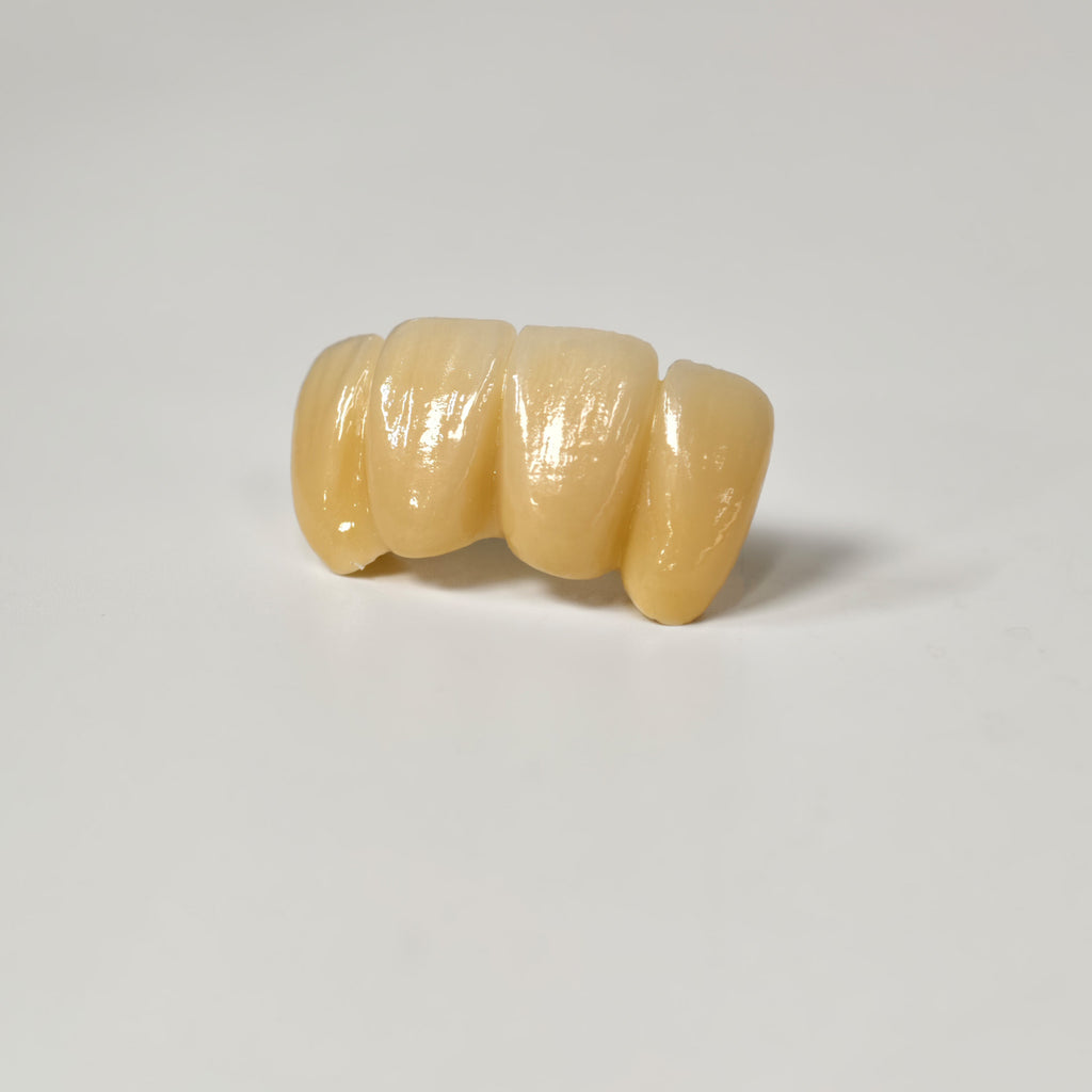 Zirconia Implant Bridge Screwmentable Dental Crown
