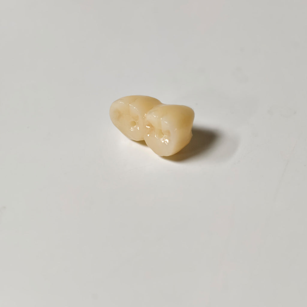 Zirconia Implant Bridge Screwmentable Dental Crown